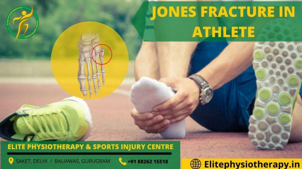 Jones Fracture in Athlete