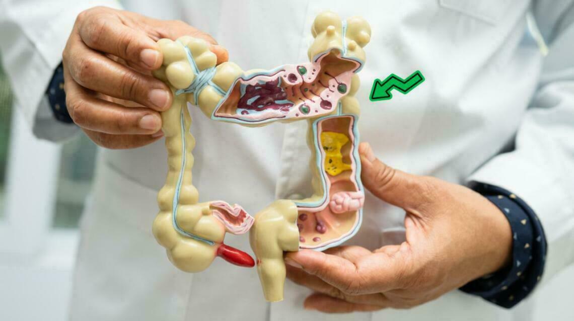 Is Your Food Being Digested or Rotting?