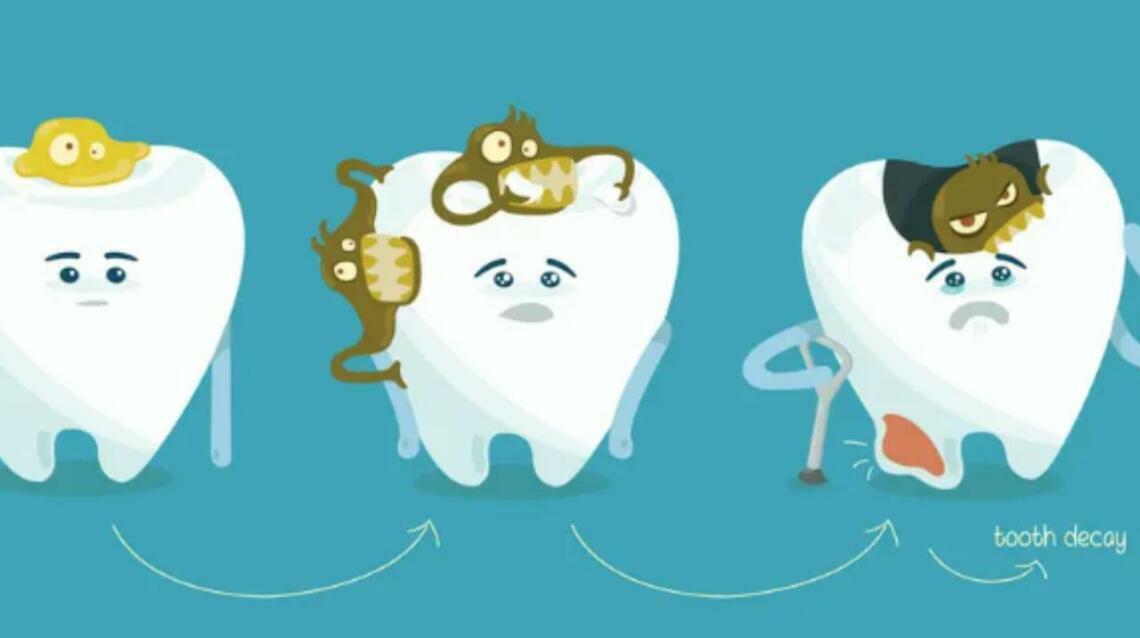 Deciphering Tooth Decay: A Comprehensive Guide to Dental Wellness