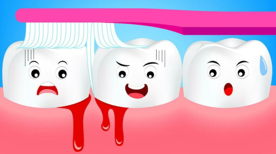 7 Everyday Tips to Cure Bleeding Gums