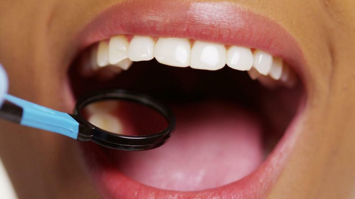 The “Food Gets Stuck Here” Tooth:why They Shouldn’t Be Ignored