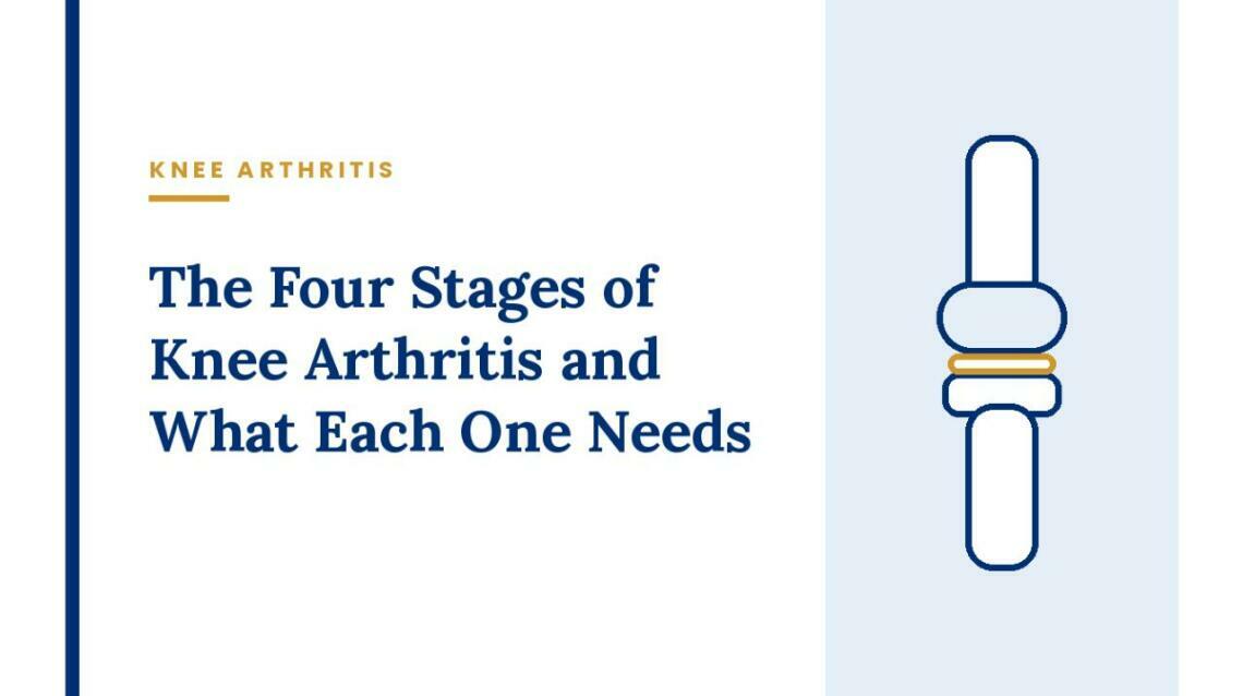 The Four Stages of Knee Arthritis and What Each One Needs