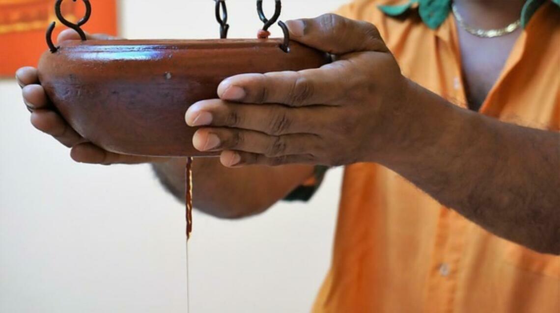 Shirodhara in Neurobehavioural Disorders Like Autism and Adhd