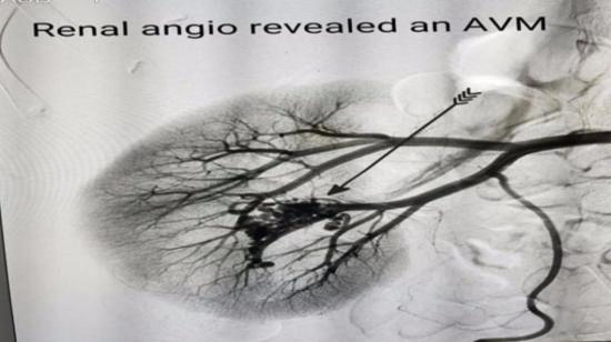 Blood in Urine Can Be Dangerous- Consult Now - Dr.Balaji Patel