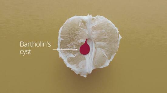 A Little Lump Down There? Don’t Freak Out Yet!