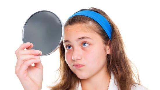 Melasma: What It Is & How to Manage It (Do’s & Don’ts)