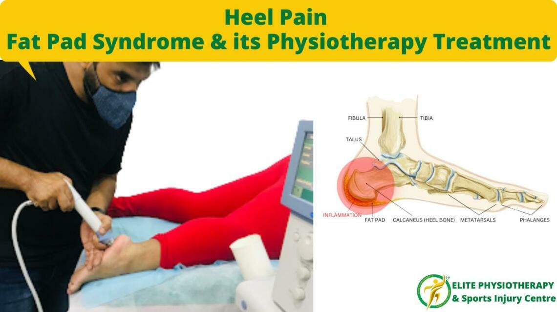 Fat Pad Syndrome Heel Pain Physiotherapy Treatment