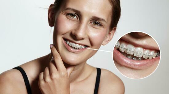 Dental Implants – Painful or Not? Truth Revealed