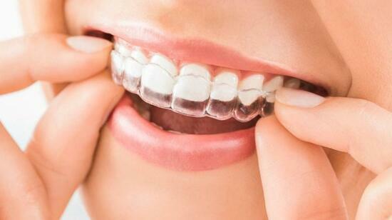 Invisalign in Mira Road – Straighten Your Smile Invisibly