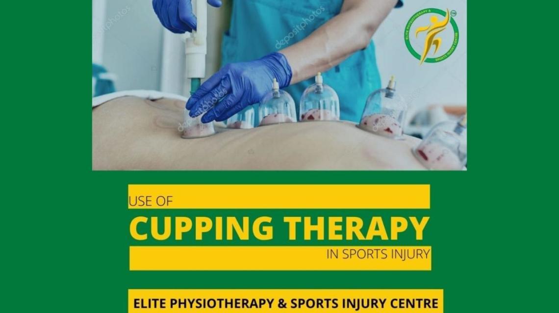 Cupping Therapy to Relief From Sports Injury
