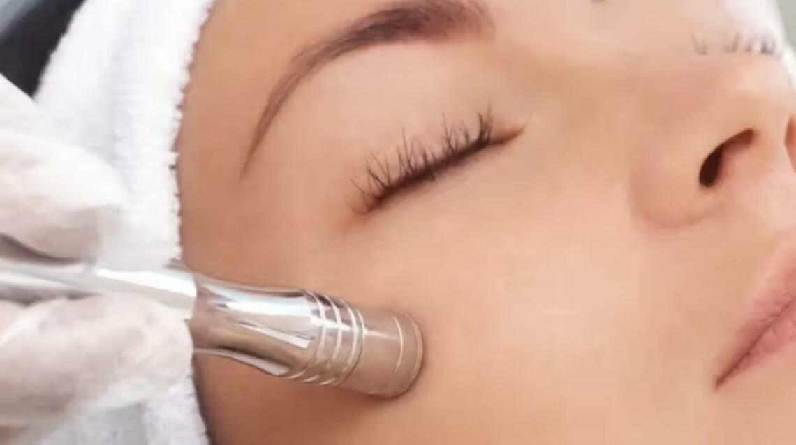 Microdermabrasion