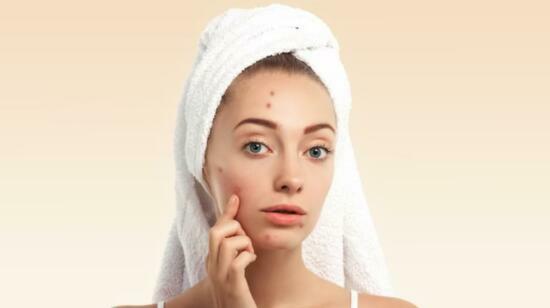Stubborn Acne Care With Proven Medical Options