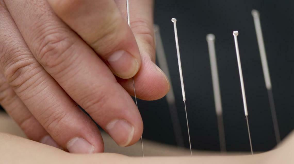 What Is Tcm(traditional Chines Medicine)