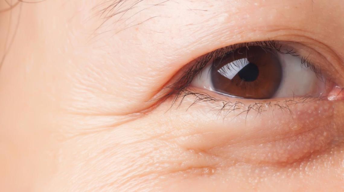 7 Ways to Reduce your Wrinkles