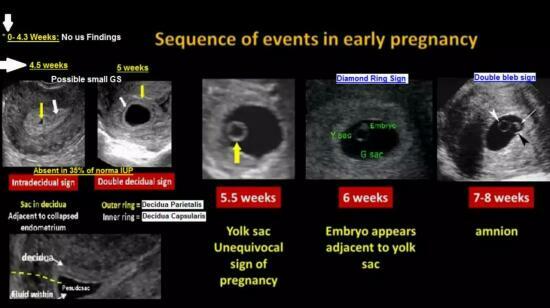 Dr. Nupur Mital's Pregnancy Care Series Part 1: