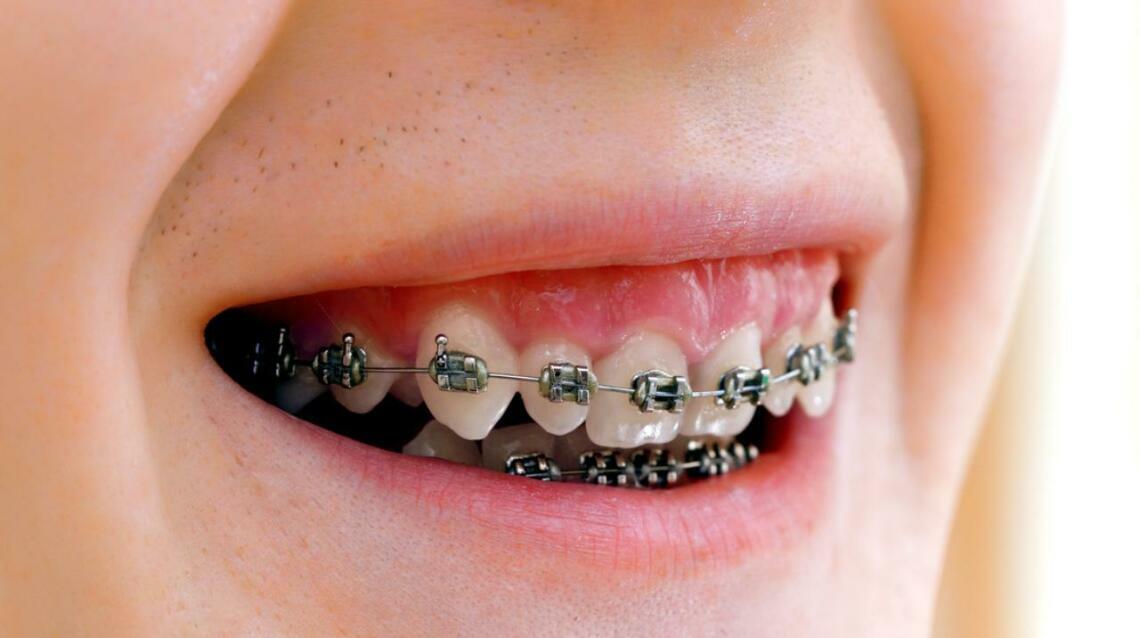 Children’s Orthodontics: When Should Your Child Get Their First Dental Check-Up?