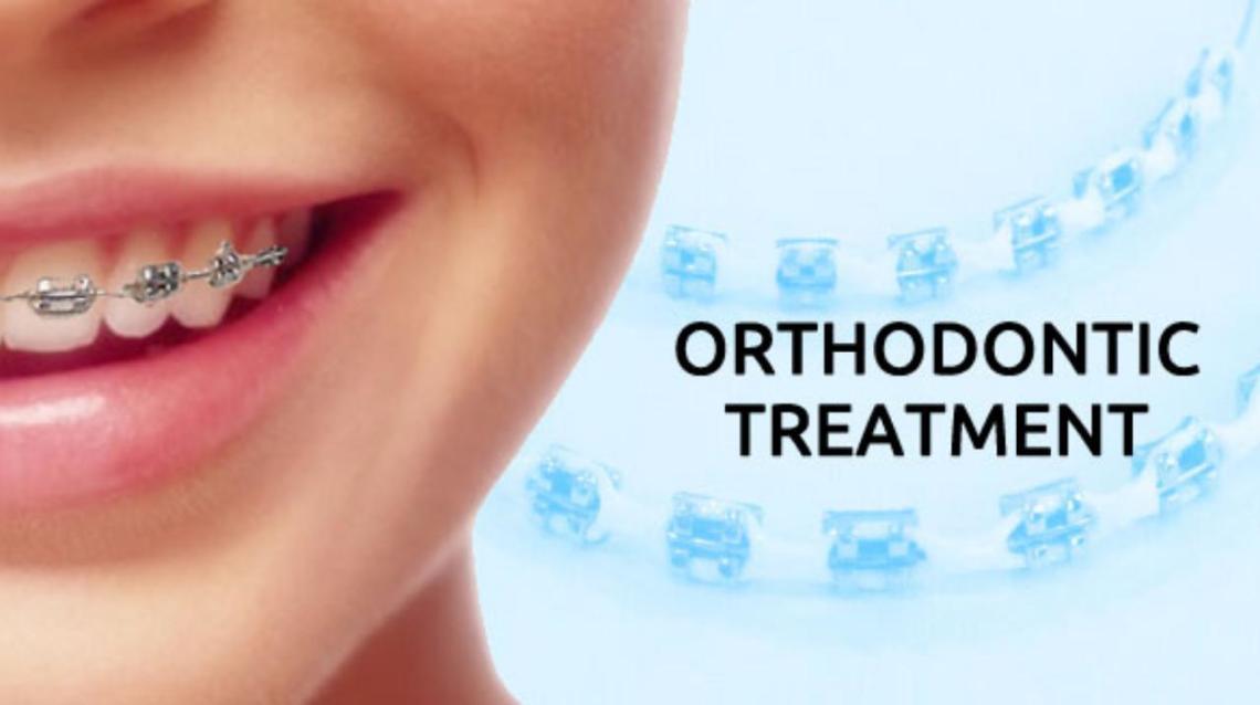 Orthodontic Treatment A Few Common Queries