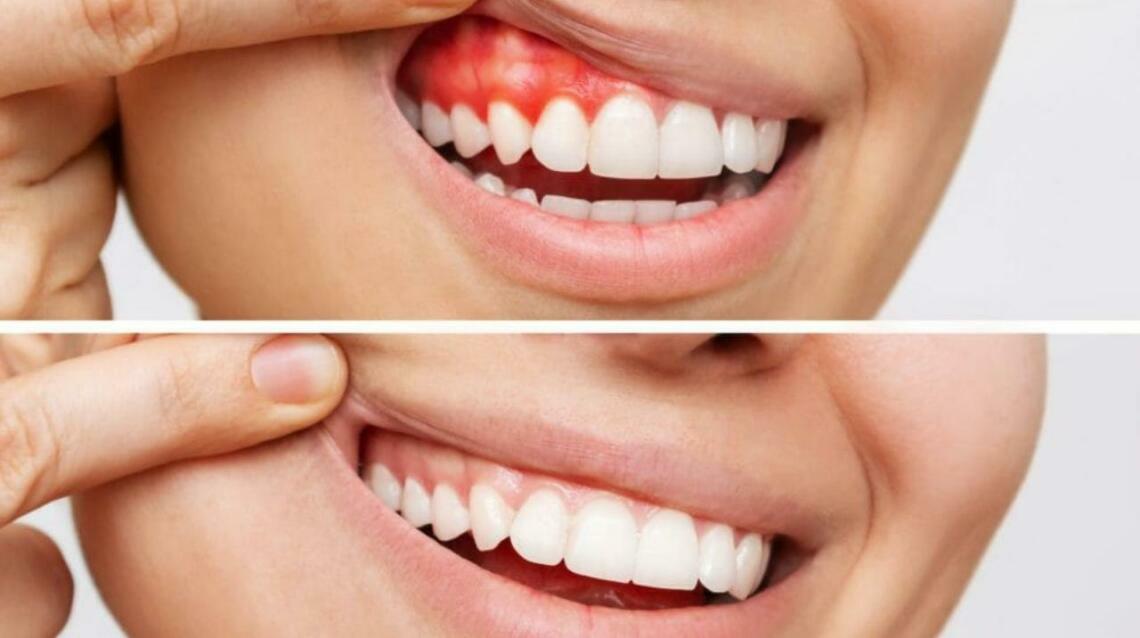 The Silent Hero: How Healthy Gums Protect Overall Health