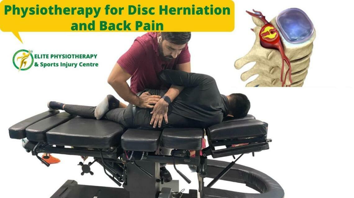 Physiotherapy for Disc Herniation and Back Pain
