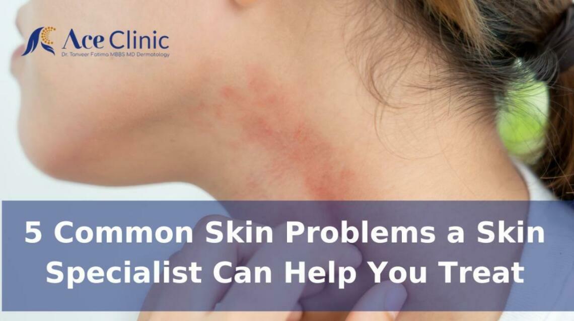 5 Common Skin Problems a Skin Specialist Can Help You Treat