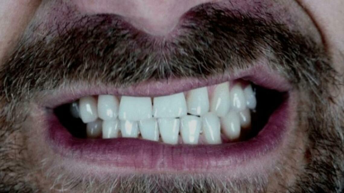 5 Tips to Avoid Teeth Grinding at Night and Its Causes??