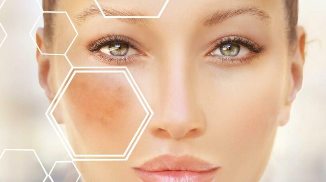 Most Effective Ingredients for Pigmentation:what Dermatologists Usually  Recommend