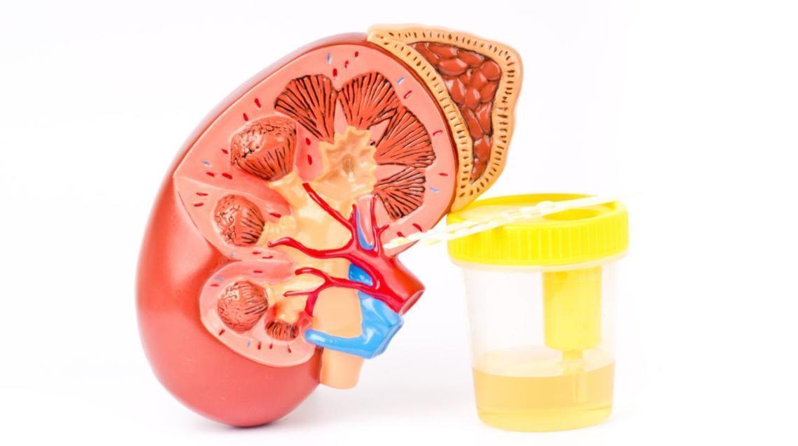 Kidney stone or gall bladder stone