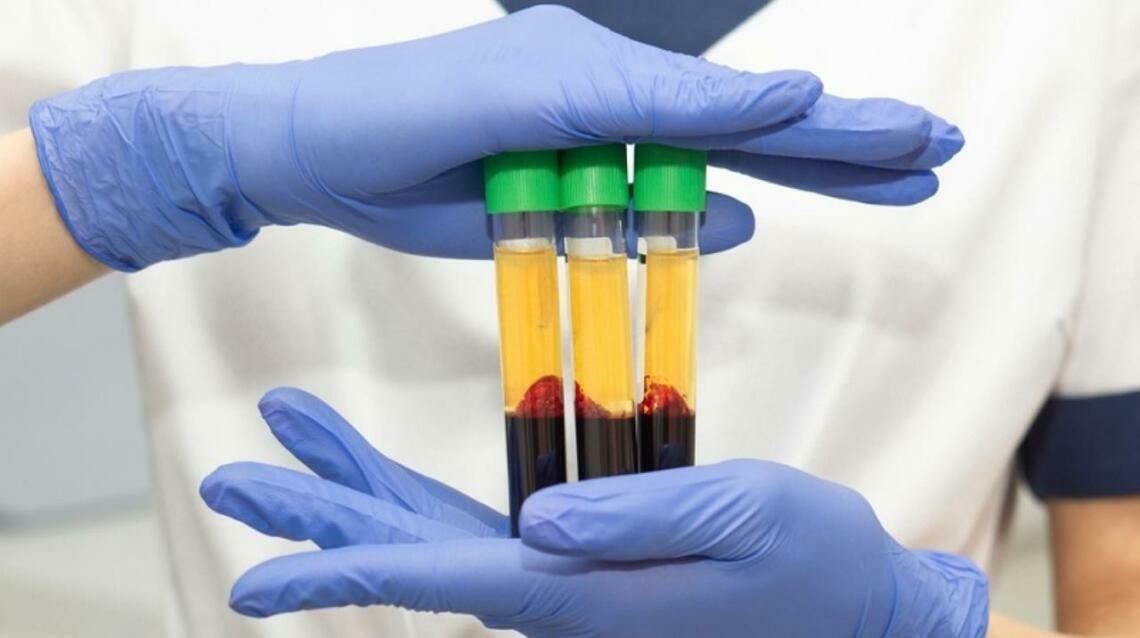 Prp in Sports Injuries