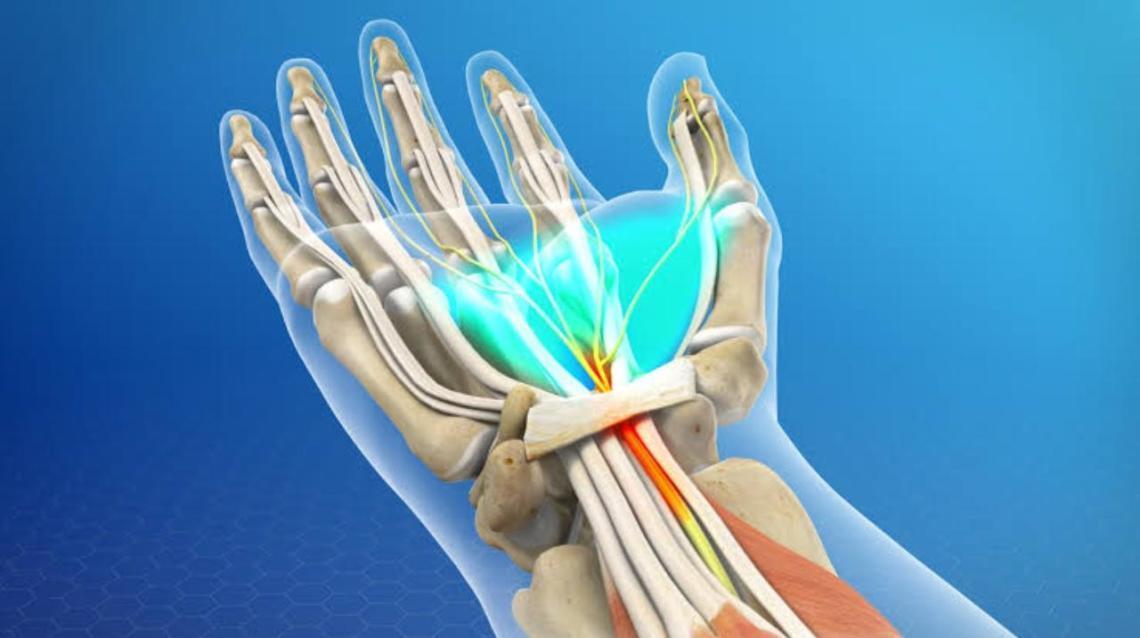 Tingling & Numbness in Hand: Carpal Tunnel Syndrome
