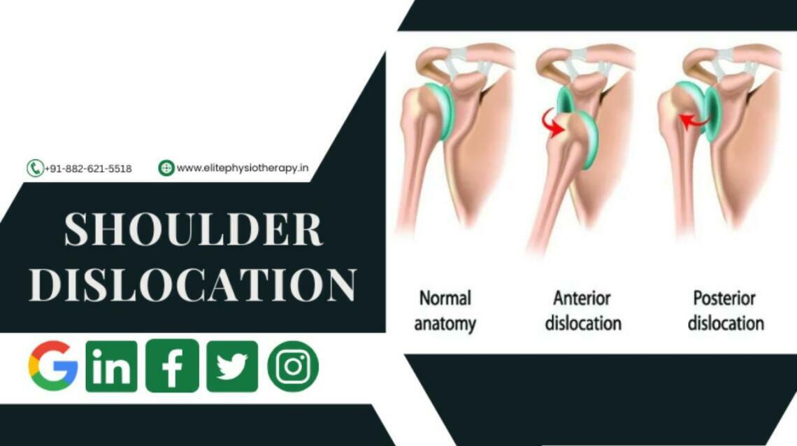 Shoulder Dislocation