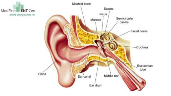 Repairing the Ear Drum- Myringoplasty