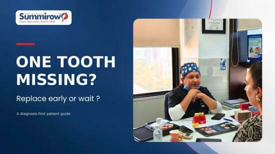 Missing One Tooth: Replace It Early or Wait?