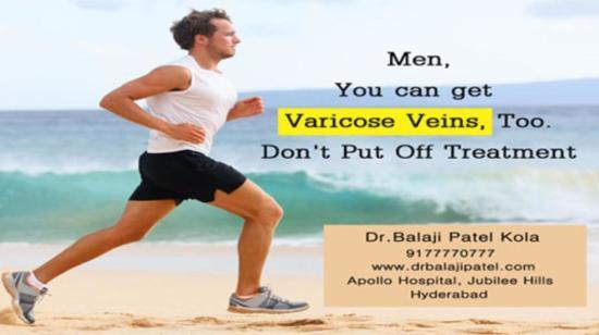 Varicose Veins Disease