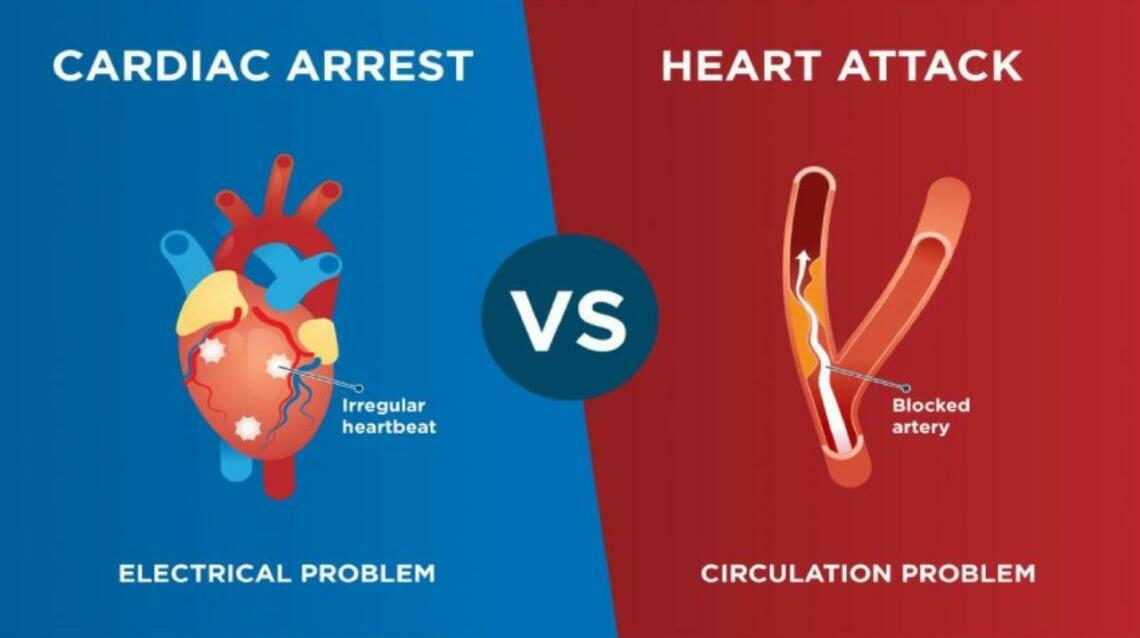 Heart Attack vs. Cardiac Arrest: Know the Difference
