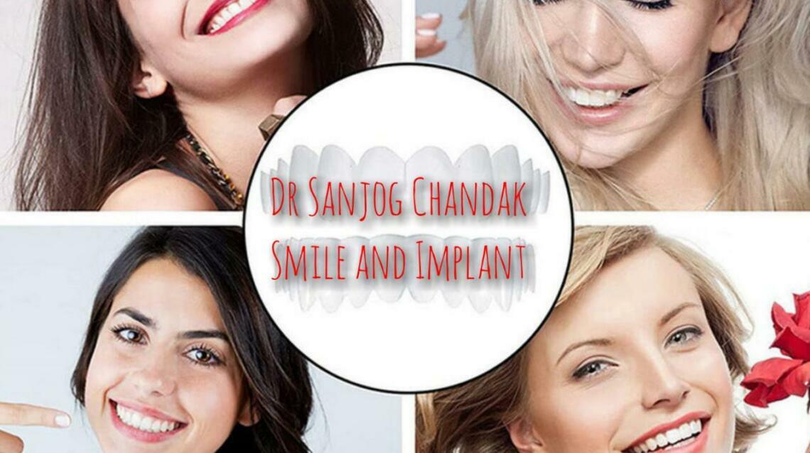 Ipr System Teeth Alignment Without Extraction