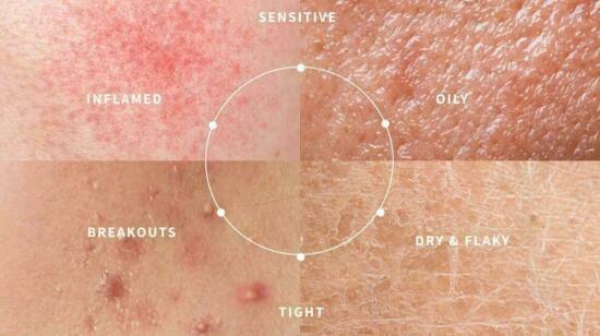 When Skincare Backfires: Understanding the Damaged Skin Barrier