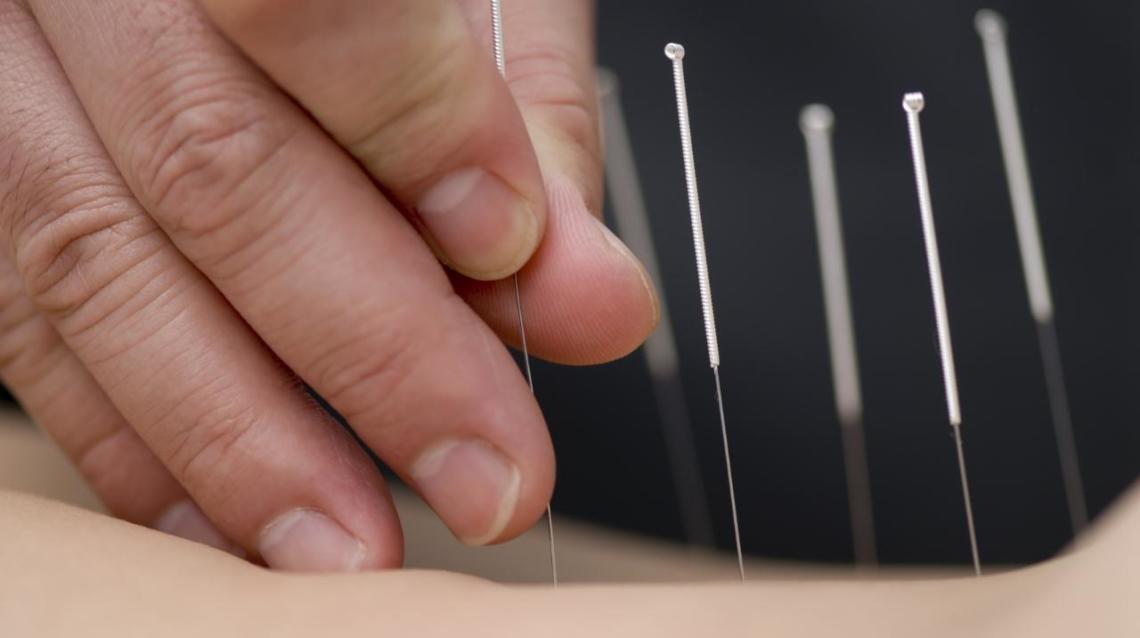 6 Key Uses of Acupuncture