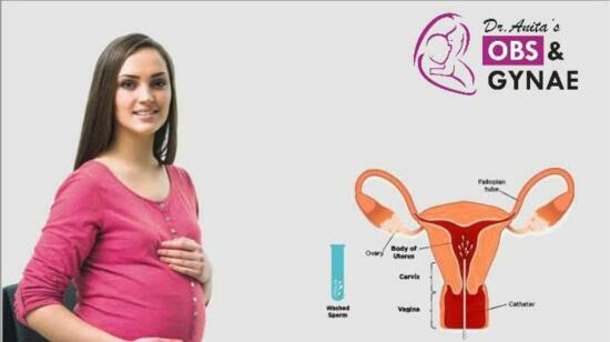 Intrauterine Insemination