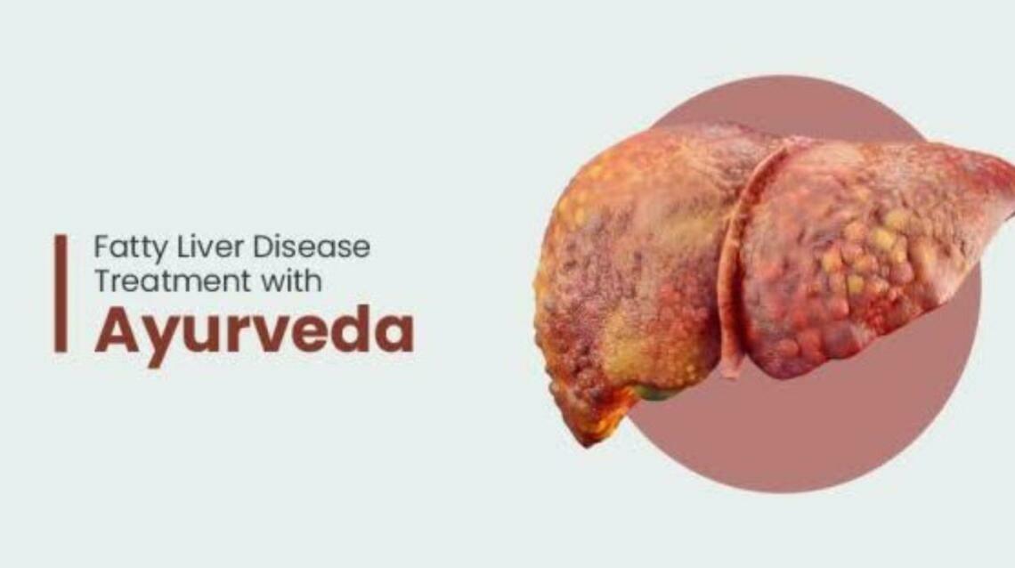 Non Alcoholic Fatty Liver Disease and Ayurveda