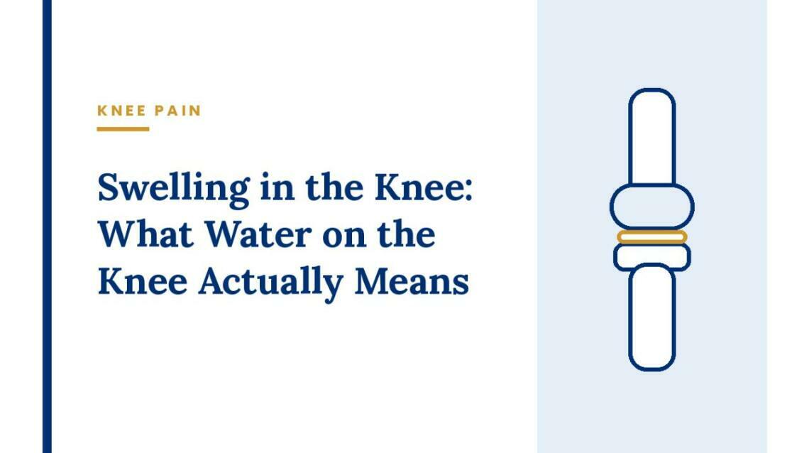 Swelling in the Knee: What Water on the Knee Actually Means