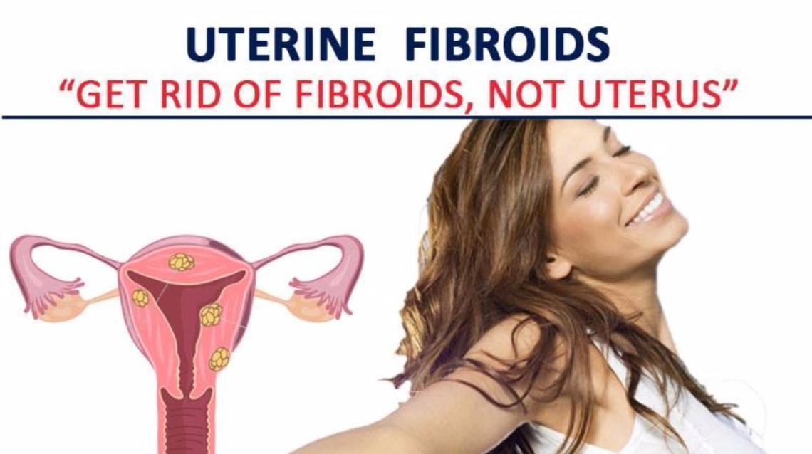 Get Rid of Fibroid and Not Uterus