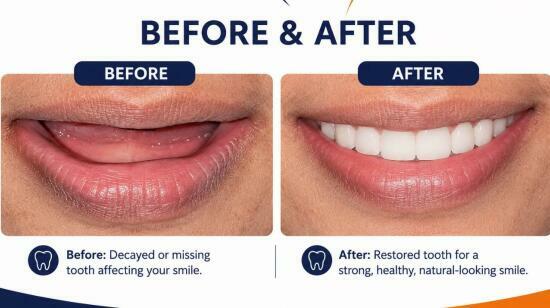 From Missing Teeth to a Confident Smile.