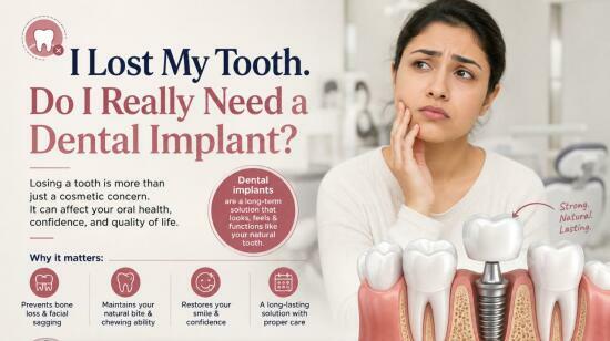 I Lost My Tooth. Do I Really Need a Dental Implant?