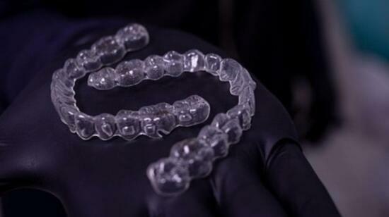 Invisalign Treatment Timeline: What to Expect Month by Month