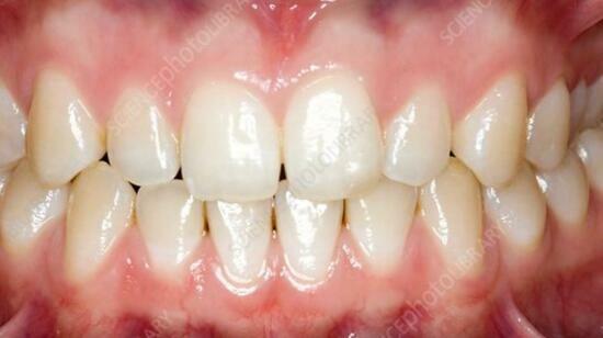 What Countries With Healthy Teeth Do Differently