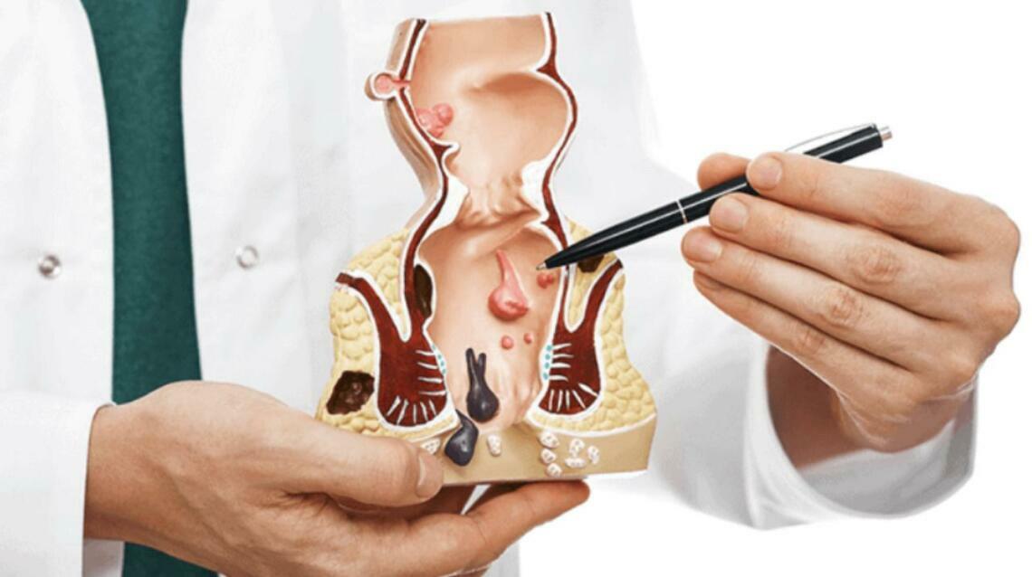 Laser vs Conventional Surgery for Haemorrhoids :  Which Option Is Right for You ?