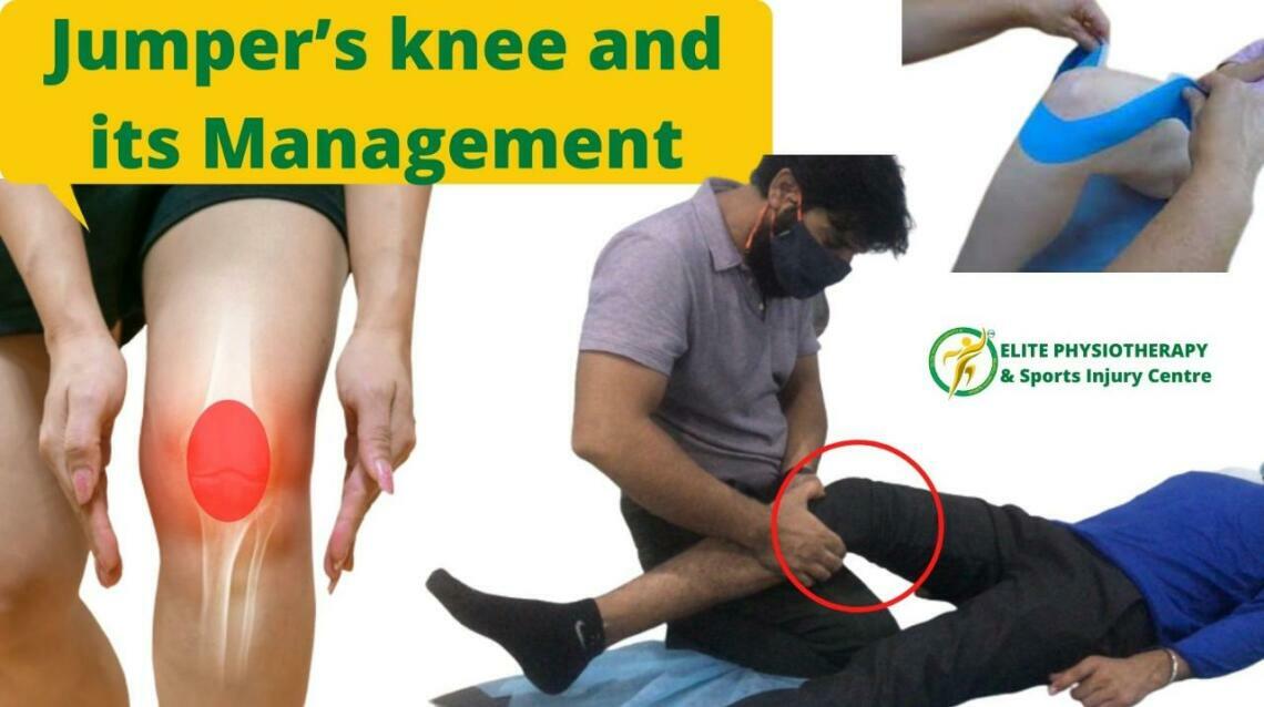 Jumper’s Knee and Its Management