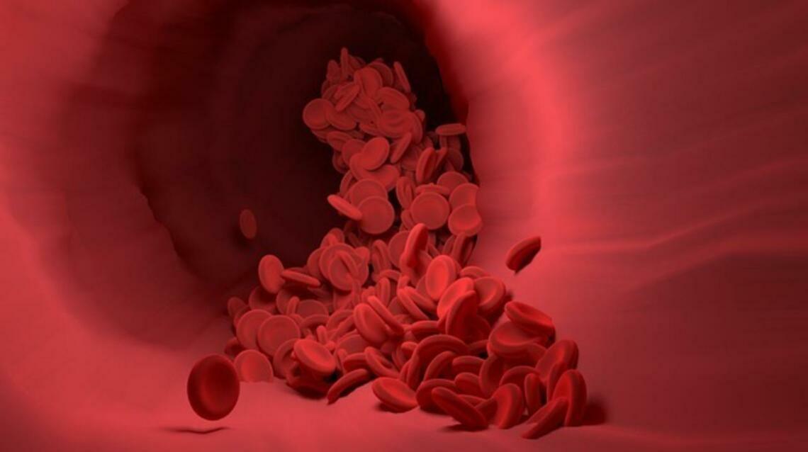 Title: Is Your Hemoglobin Low? Here's What You Should Know