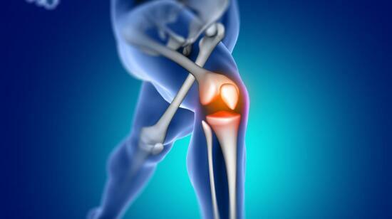 When Is Knee Replacement Surgery Necessary?