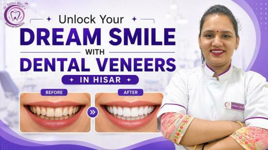 Unlock Your Dream Smile With Dental Veneers in Hisar